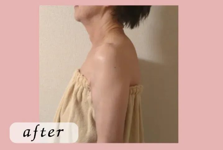 肩まわり施術後